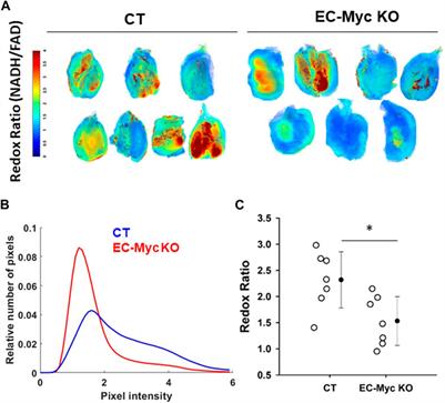 Endothelial c-Myc knockout disrupts metabolic homeostasis and triggers the development of obesity